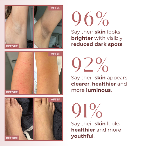 OUTLY® Glow Reset Peel Spray