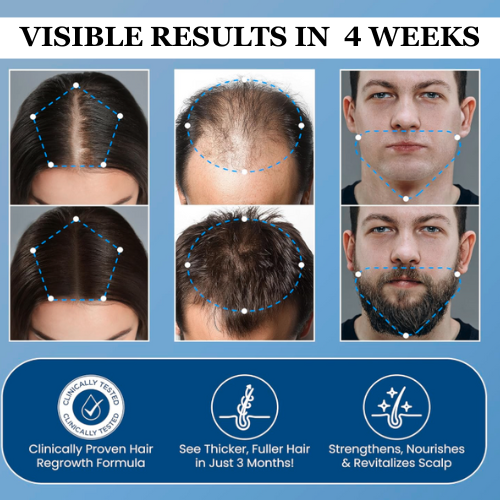 OUTLY® Hair Growth Roll on Serum