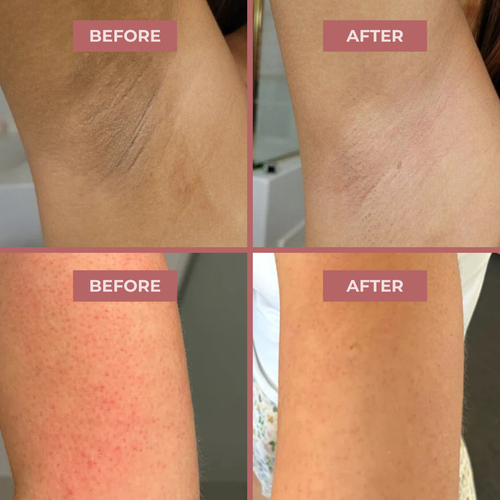 OUTLY® Glow Reset Peel Spray