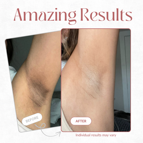 OUTLY® Glow Reset Peel Spray