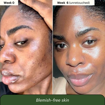 Dark Spot Reset Turmeric Bar