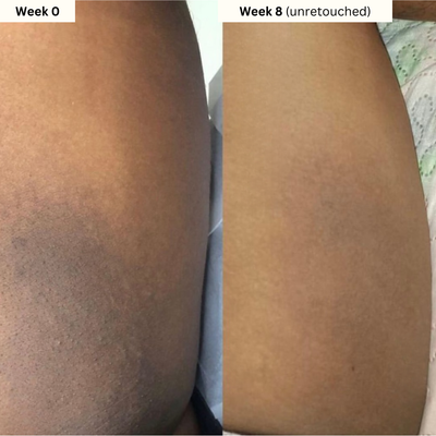 Dark Spot Reset Turmeric Bar