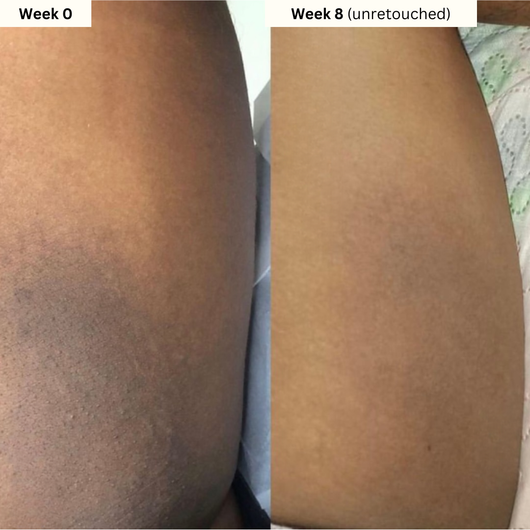 Dark Spot Reset Turmeric Bar