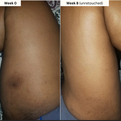 Dark Spot Reset Turmeric Bar