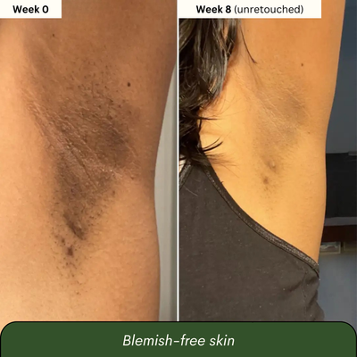 Dark Spot Reset Turmeric Bar