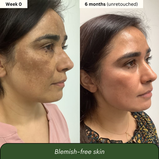 Dark Spot Reset Turmeric Bar