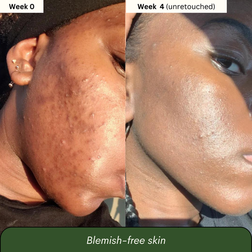 Dark Spot Reset Turmeric Bar