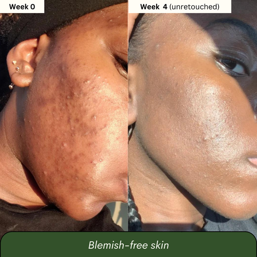 Dark Spot Reset Turmeric Bar