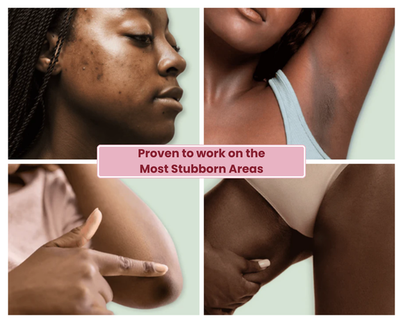 Feature product image