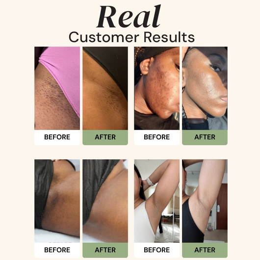 Dark Spot Reset Turmeric Bar