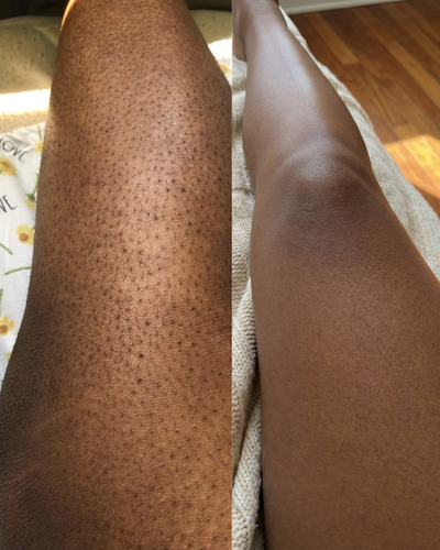 Dark Spot Reset Turmeric Bar