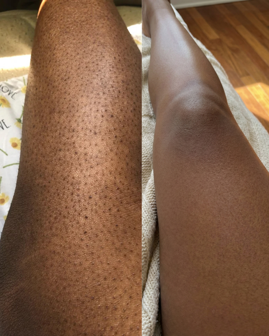 Dark Spot Reset Turmeric Bar